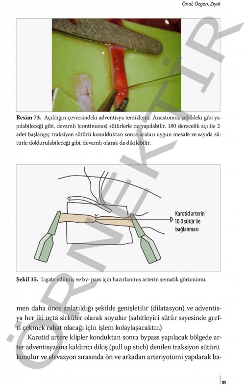 Mikronöroşirürjide Laboratuvardan Pratiğe