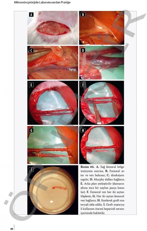 Mikronöroşirürjide Laboratuvardan Pratiğe